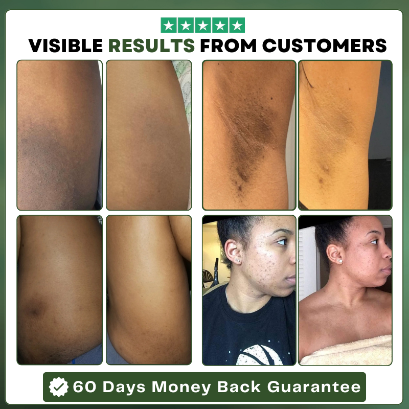 Tummeric & Kojic Acid Soap